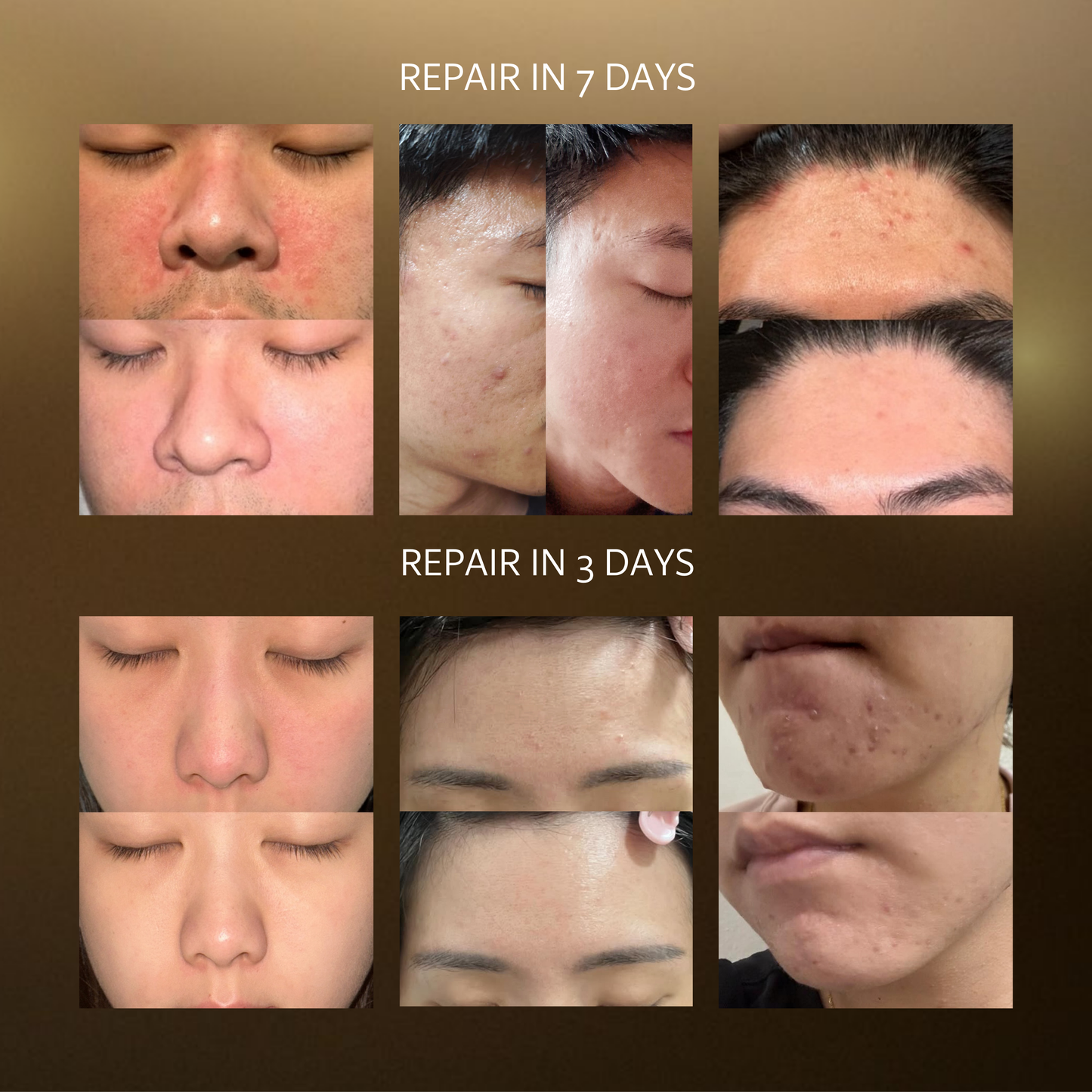 Prurity Collagen Boost Mask 胶原炮面膜
